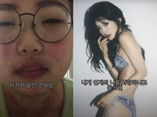 같은 사람 맞아?… 46㎏ 넘게 뺀 최준희, 충격 변화 공개