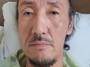 한기범 회장, 최근 선종 제거 수술받아…