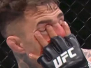 UFC 헤비급 챔피언, 상대 암수에 실명 위기...
